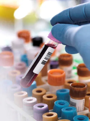 Complete Lab Testing