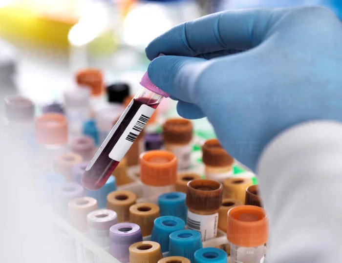 Complete Lab Testing